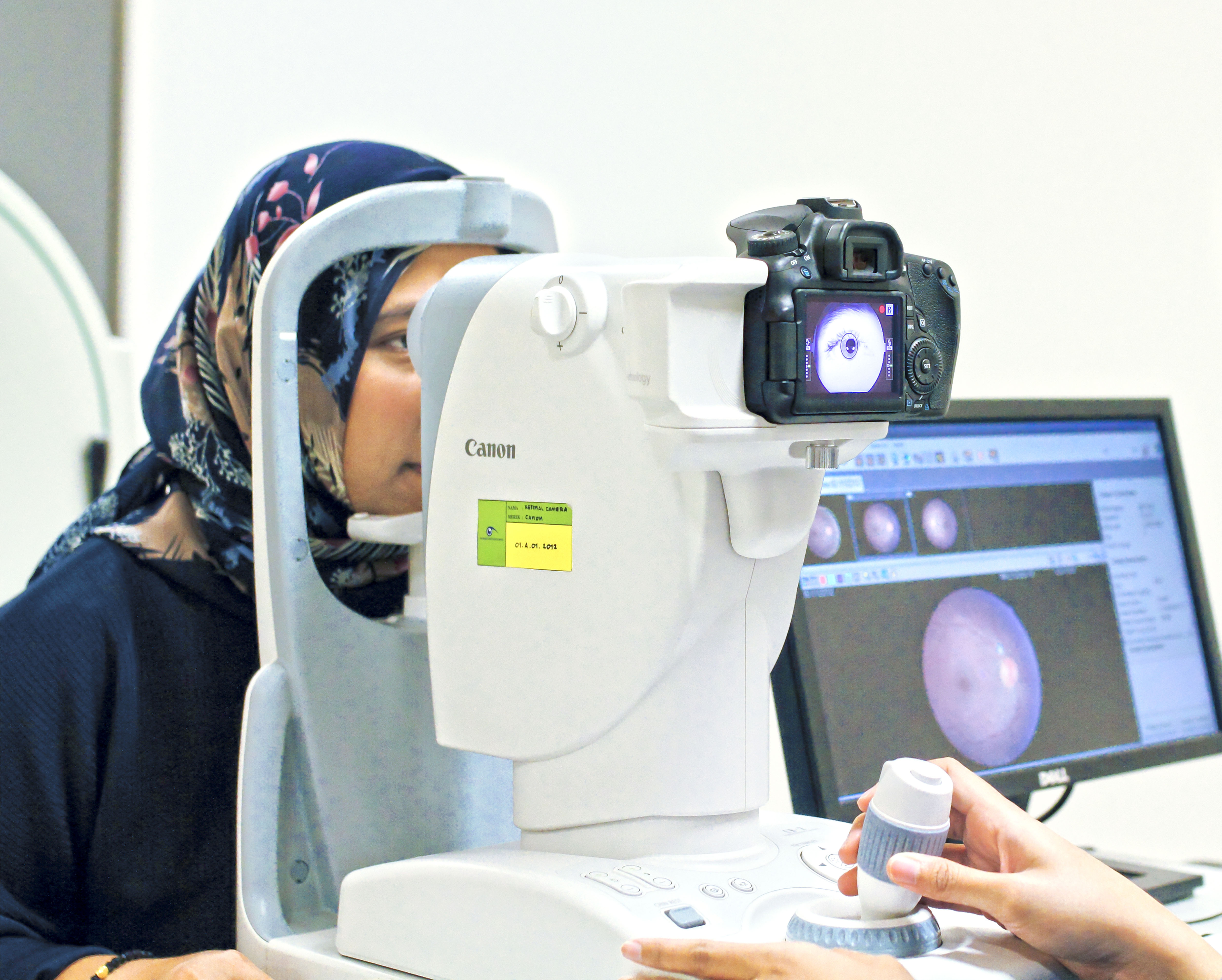 Foto Fundus