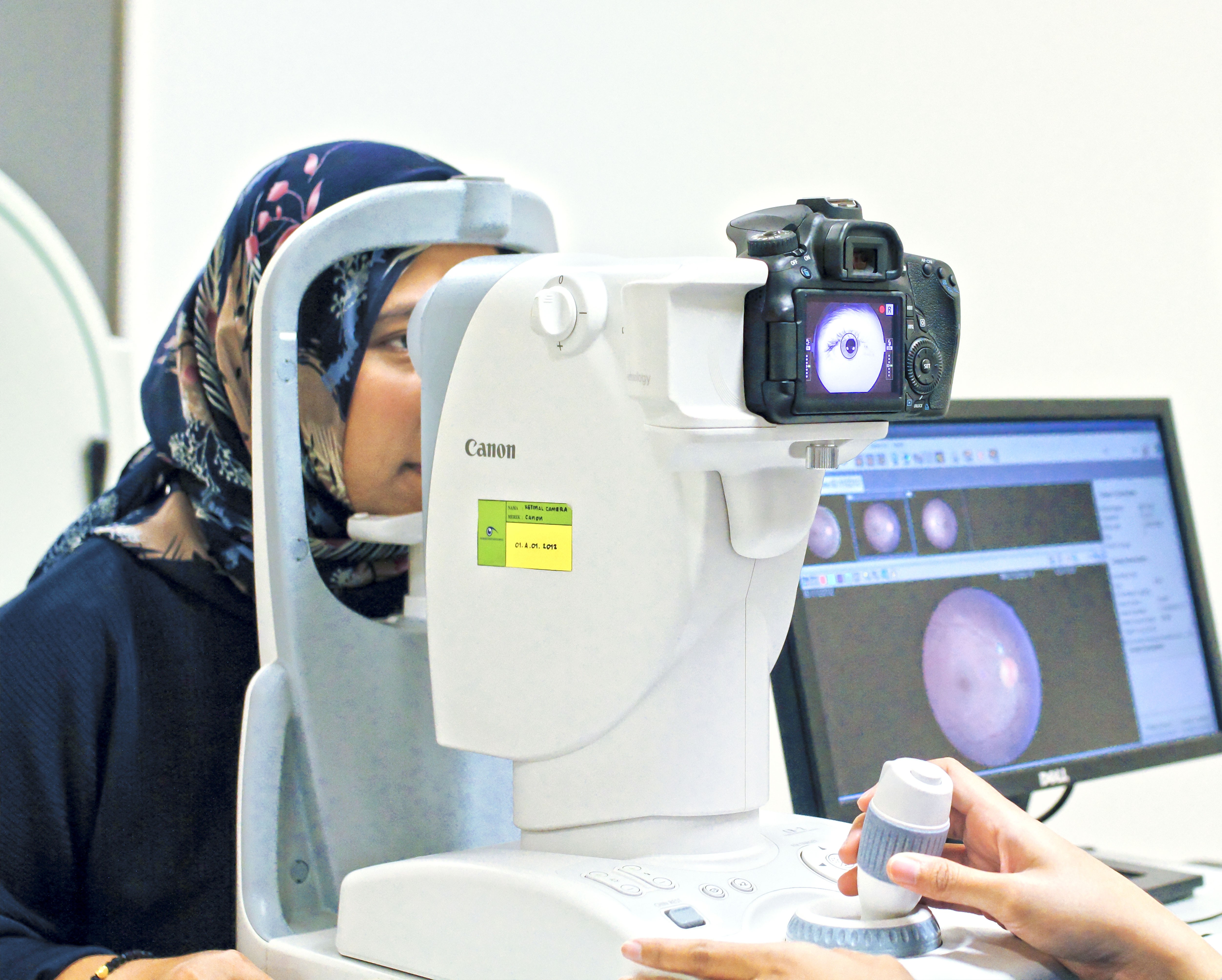 Foto Fundus